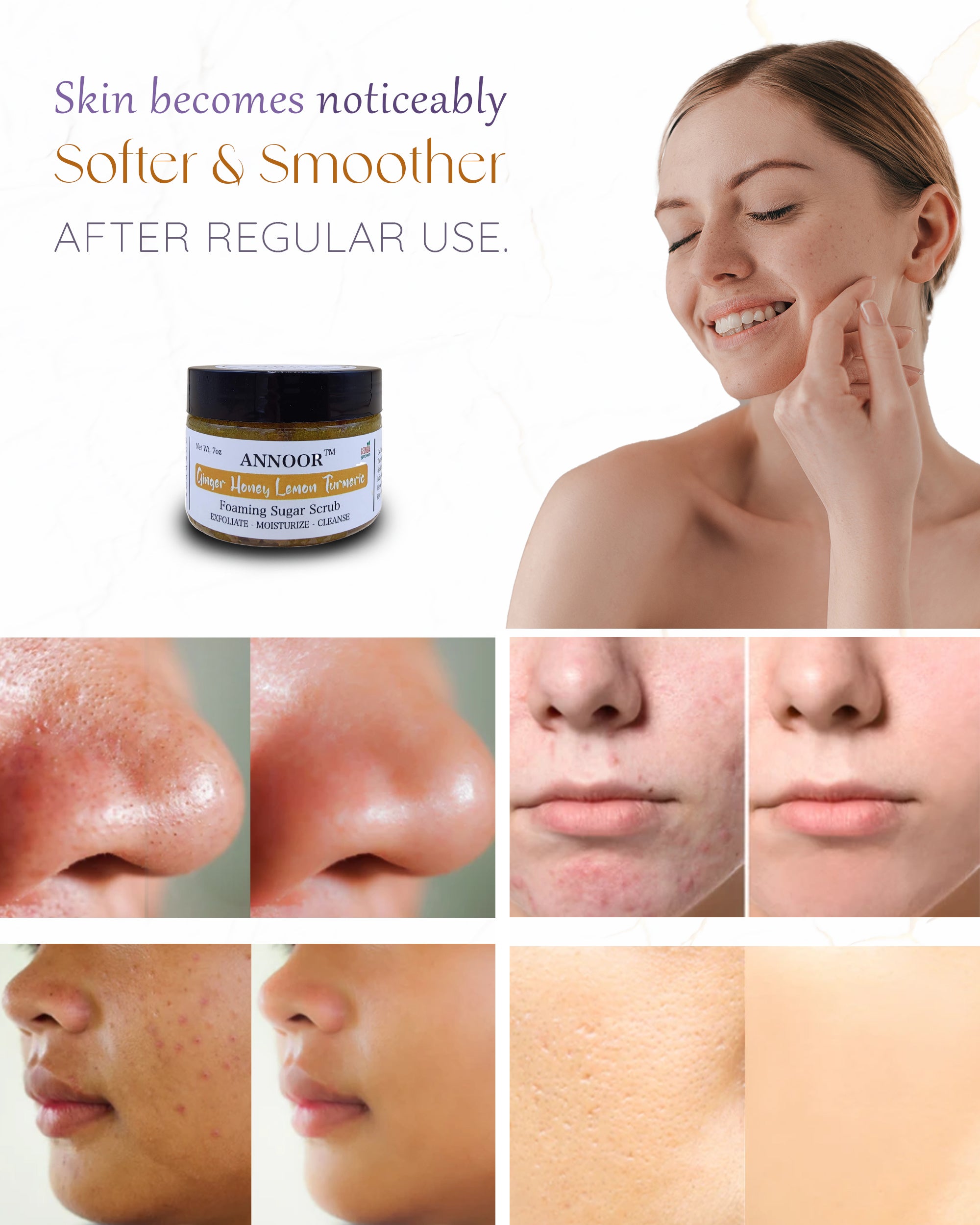 Organic Foaming Sugar Scrub by Annoor - 7 Oz|Ginger, Honey, Lemon, Turmeric |No Parabens, Sulphates, No Harmful Chem |Face and Body Exfoliating