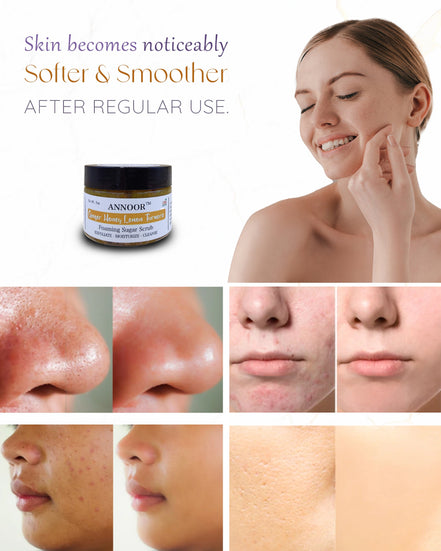 Organic Foaming Sugar Scrub by Annoor - 7 Oz|Ginger, Honey, Lemon, Turmeric |No Parabens, Sulphates, No Harmful Chem |Face and Body Exfoliating