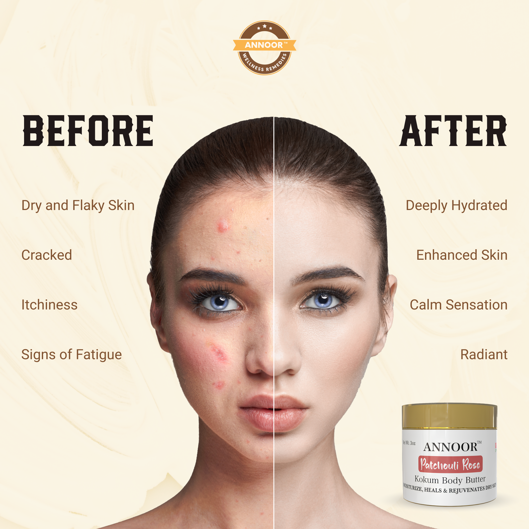 Annoor Hydrating Body Butter – Kokum Butter with Rose & Patchouli for Dry Skin (4 oz)