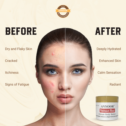 Annoor Hydrating Body Butter – Kokum Butter with Rose & Patchouli for Dry Skin (4 oz)